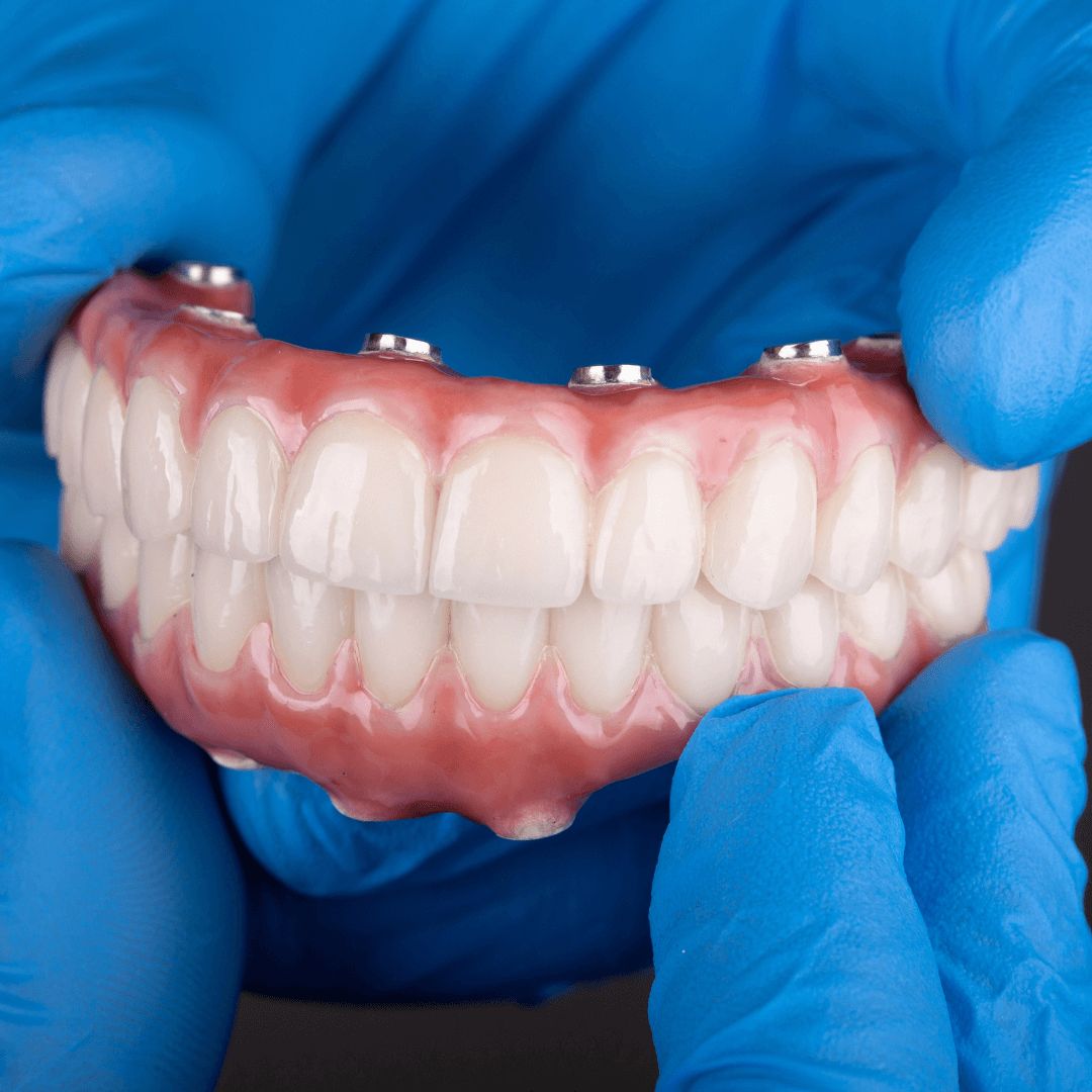 Dental prosthesis held by gloved hands